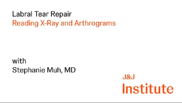 MRI & Xray Review Labral Tear Shoulder with Stephanie Muh, MD thumbnail image