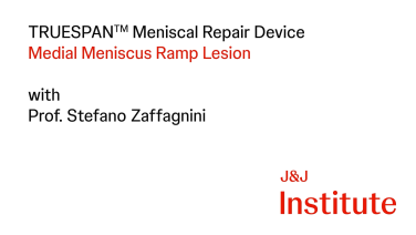 Image from Meniscal Repairs with TRUESPAN Meniscal Repair Device with Prof. Stefano Zaffagnini