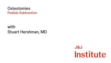 Osteotomies: Pedicle Subtraction with Stuart Hershman, MD thumbnail