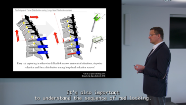 Innovative Technologies for Addressing Unmet Needs in Posterior Cervical Spine with Dr. Heido Koller thumbnail