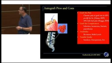 Slide from Biometrics in Spinal Fusion: The Pros and Cons of Autograft with Jamie Lawrence, MD