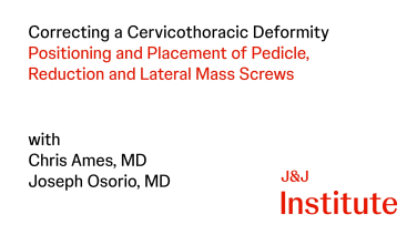 Correcting a Cervicothoracic Defomity using SYMPHONY OCT with Chris Ames, MD & Joseph Osorio, MD thumbnail