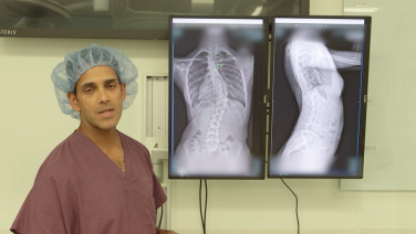 Posterior Correction of Adolescent Idiopathic Scoliosis with Attention to Differential Rod Contouring with Suken Shah, MD