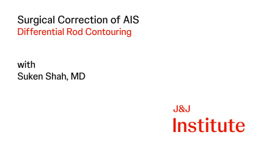 Posterior Correction of Adolescent Idiopathic Scoliosis with Attention to Differential Rod Contouring with Suken Shah, MD thumbnail