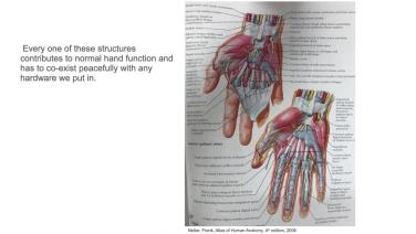 Hand and Wrist diagram from Anatomy and Surgical Challenges in Hand Surgery with Amy Speeckaert, MD