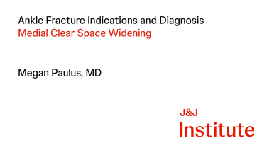 Thumbnail image of Ankle Fractures Indications with Megan Paulus, MD
