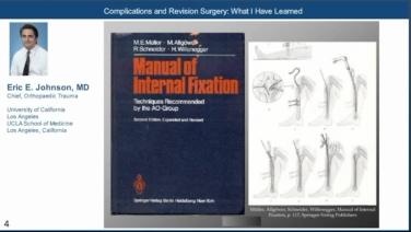 slide from the video series Complications and Revision Trauma Surgery - Eric Johnson, MD