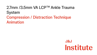 thumbnail image of 2.7mm / 3.5mm VA-LCP Ankle Trauma System: Technique Animation