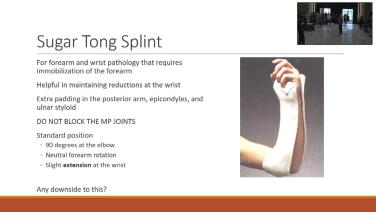 Slide of the splint from "Elbow Forearm and Wrist Splinting with Travis M. Hughes, MD"