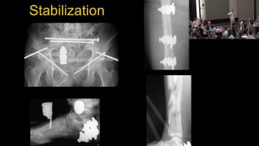 Reliable Routines for Polytrauma Patients with Timothy Achor, MD