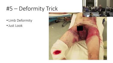 Pelvic Ring and Hip Fixation with Chip Routt, MD