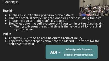 Ankle Brachial Index: When, Why & How with Ronald Cox, MD