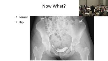 Urgent Conditions: Identifying Specific Fractures with Chip Routt, MD
