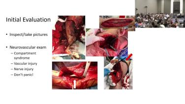 Urgent Conditions: Current Standards for Open Fractures with Douglas Haase, MD