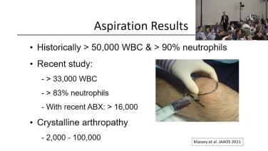 "Traumatic Arthrotomies, Septic Arthritis & Soft Tissue Emergencies with Jonathan Eastman, MD"
