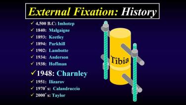 a slide from Rational Uses of External Fixation in Foot & Ankle Surgery with Thomas Roukis, DPM