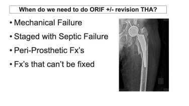 Managing Periprosthetic Femur Fractures with Frank Liporace, MD; Cory Collinge, MD & George Haidukewych, MD