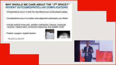 Managing the 3rd Space in Total Knee Arthroplasty with Kevin Perry, MD