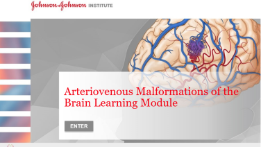 An image from the "Arteriovenous Malformations of the Brain" on JnJInstitute.com website