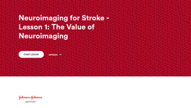 An image from the "Neuroimaging for Stroke" on JnJInstitute.com website