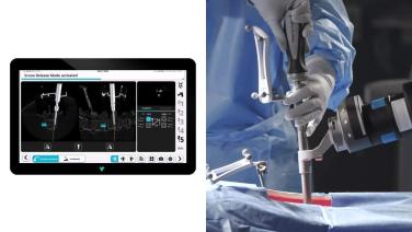 VELYS procedure done on a screen for the first half and the second half is an HCP using the medical device from "Open TriALTIS Workflow"