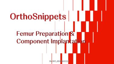 An Image From "DAA with ACTIS - Femur Preparation & Component Implantation"