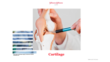 An image from the "Cartilage" on JnJInstitute.com website