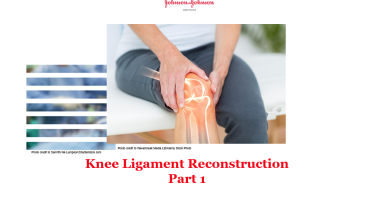 An image from the "Knee Ligament Reconstruction Part 1" on JnJInstitute.com website