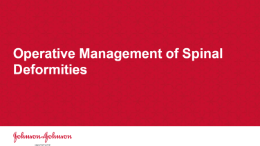An image from the "Operative Management of Spinal Deformities" on JnJInstitute.com website