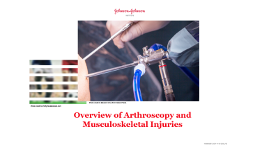 An image from the "Overview of Arthroscopy and Musculoskeletal Injuries" on JnJInstitute.com website
