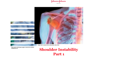 An image from the "Shoulder Instability Part 1" on JnJInstitute.com website