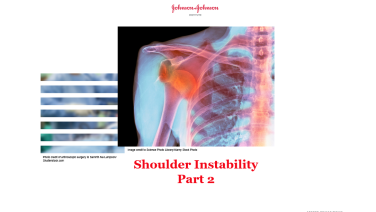 An image from the "Shoulder Instability Part 2" on JnJInstitute.com website