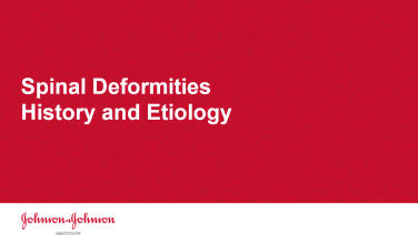 An image from the "Spinal Deformities-History and Etiology" on JnJInstitute.com website