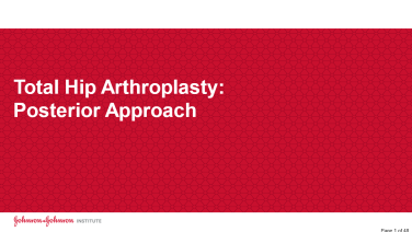 An image from the "Total Hip Arthroplasty: Posterior Approach" on JnJInstitute.com website