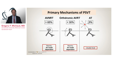 An image from the "Diagnostic SVT Maneuvers with Gregory F. Michaud, MD" playlist on the JnJInstitute.com website.