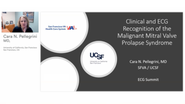 An Image From "Clinical and ECG Recognition of the Malignant Mitral Valve Prolapse Syndrom with Cara Pellegrini, MD"