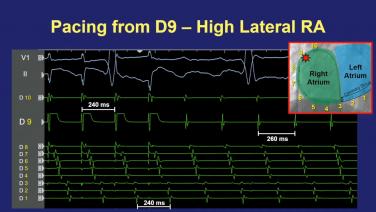 An image from the "Principles of Entrainment with Joshua Cooper, MD" playlist on the JnJInstitute.com website.