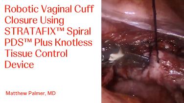 An image of the "STRATAFIX Spiral PDS Plus Knotless Tissue Control Device - Robotic Vaginal Cuff Closure" video.
