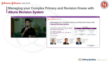 SEA Webinar - Managing Complex Primary & Revision Knees with Attune Revision & Live Surgical Demonstration thumbnail
