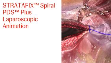 An image of the "STRATAFIX Spiral PDS Plus Laparoscopic Animation" video.