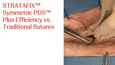 An image from the "STRATAFIX™ Symmetric Efficiency vs. Traditional Suture" video on JnJInstitute.com