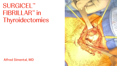 An image From "SURGICEL™ FIBRILLAR™ in Thyroidectomies with Alfred Simental, MD"