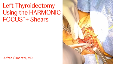 An Image From "Left Thyroidectomy Using the HARMONIC FOCUS™+ Shears with Alfred Simental, MD"