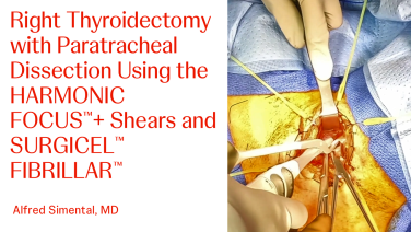 An Image From "Right Thyroidectomy with Paratracheal Dissection Using the HARMONIC FOCUS™+ Shears with Alfred Simental, MD"