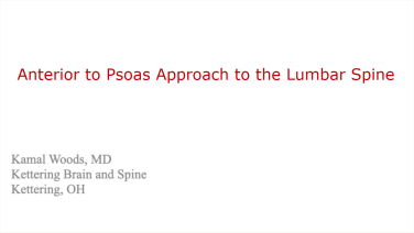 Am image from the "Anterior to Psoas Approach to the Lumbar Spine with Kamal Woods, MD" playlist on the JnJInstitute.com website.