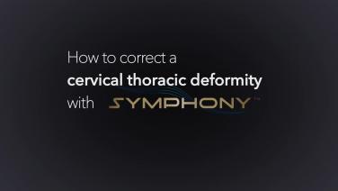 An image from the "Correcting a Cervico-Thoracic Deformity using the SYMPHONY™ OCT System with Dr. Christopher Ames & Dr. Joseph Osorio" playlist on the JnJInstitute.com playlist.