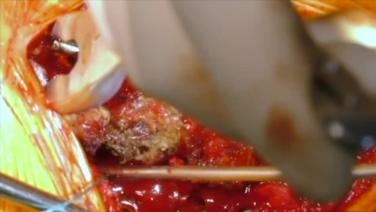 An Image From "Lateral Mass Exposure"