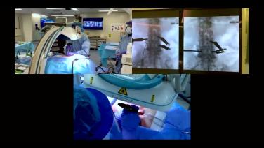 An Image From "MIS TLIF: Pedicle Targeting"
