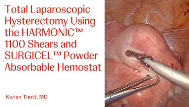 An Image From "Total Laparoscopic Hysterectomy Using HARMONIC™ 1100 Shears and SURGICEL™ Powder Absorbable Hemostat with Kurian Thott, MD"