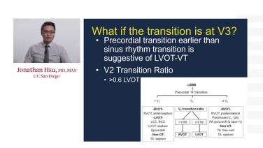Ventricular Arrhythmia Localization Using the EKG: Outflow Tract Anatomy Correlates with Jonathan Hsu, MD thumbnail